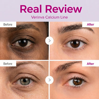 🔥LAST DAY 50% OFF!! Verinva Korean Calcium Dark Spot Eye Cream